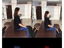 ストレチックス 近江八幡店/ストレッチ　ビフォーアフター