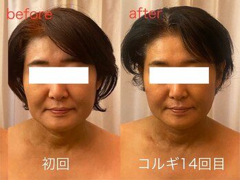 ビーキュート 神戸元町店(BE-CUTE)/小顔コルギ10回目