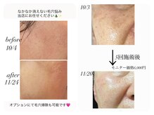 何をしても消えなかったシミ、シワ、たるみ。短期間で結果出し◎