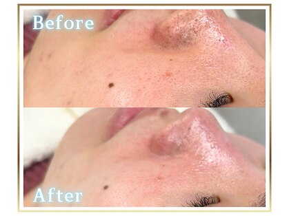 ピュアスキンサロン 恵比寿店(pure skin salon)の写真