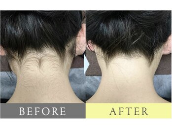 都度払いサロン Clear+ 泡瀬店【クリアプラス】脱毛/フェイシャル/痩身/バストケア/美肌全身脱毛