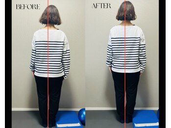 春日整体院ito/【姿勢改善ビフォーアフター】