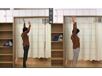 おざき鍼灸接骨院 渋見院/痛みで肩が上がらい 改善写真