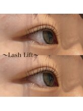 リボーンビューティーリゾート(re-born Beauty Resort)/リフト(立ち上げ)