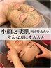 【1ヶ月以内】小顔矯正＆剥離なしハーブピーリング¥21450→¥18700