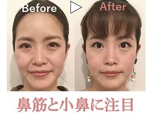 ラプリアンジュ 鹿児島天文館店(Raplit ange)の雰囲気（お顔が全体的がスッキリと一回り小さく！お鼻も細くなり小顔に♪）