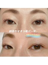 エイティピカル(Atypical)/まつ毛パッチリ華やかな印象に☆