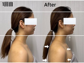 ベール(BEHL)/コルギのBefore After