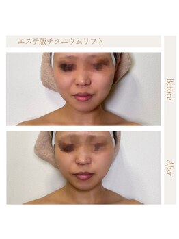 アモ 夢シティ新下関(AMO.)/チタニウムリフト