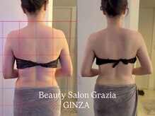 グラツィア 銀座(Grazia)/1回【 ブライダルエステ整体 】