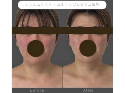ジーニー(JINNY)の写真