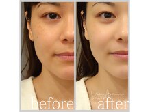 アン グレーヌ 自由が丘(unegraine)/健康的で魅力的な表情に！