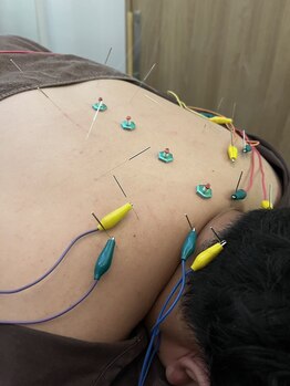 ハリマジック 代官山(HARI MAGIC)/【代官山/鍼灸/美容鍼】