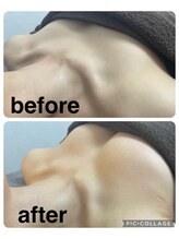 ギンザアール(GINZA R.)/平日お得にバストケア♪