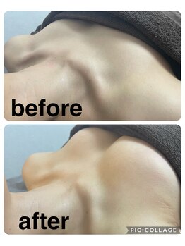 ギンザアール(GINZA R.)/平日お得にバストケア♪