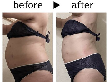 サロン ド ユキフラン(Salon de Yukifranc)/施術部位→お腹・ウエスト