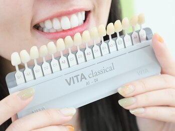 ホワイトニングサロン 三重県桑名店/ホワイトニングSTEP.1