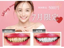 エクシアホワイトニング 稲沢店