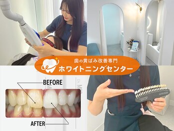 ホワイトニングセンター 長野駅前店/【長野市ホワイトニング】
