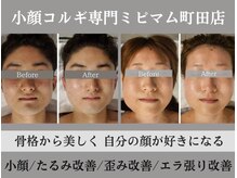 ミピマム 町田店