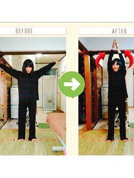 サプライズ整体院/20代ママさんの肩こり初回結果