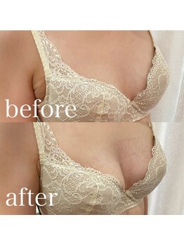 ディーソワン(De-soin)/