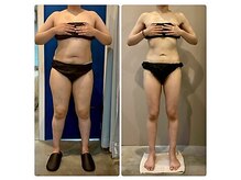 ラヴィニティ 自由が丘店(Lavinity)/【30代】ビフォー、アフター