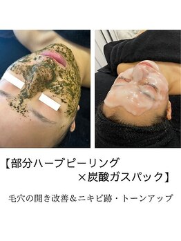 ラペカ(Lapeca)の写真/W毛穴ケアでエステ最高峰の変化を実感【REVI部分ハーブピーリング+全顔炭酸ガスパック/9900】で毛穴レス♪