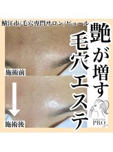 ピュール 鯖江店(PUR)/毛穴/毛穴ケア/毛穴洗浄