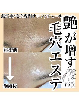 ピュール 鯖江店(PUR)/毛穴/毛穴ケア/毛穴洗浄