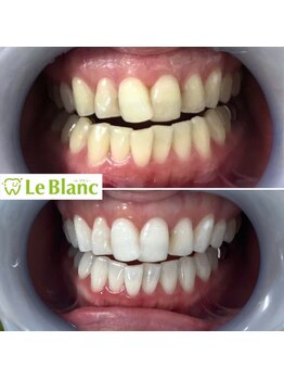 ルブラン 奈良店(Le Blanc)/赤いリップも映える!