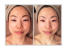 アン グレーヌ 自由が丘(unegraine)/パッと視界が開ける！