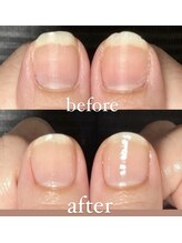 ハンハウス(Hanhouse)/ネイルケアで整った自爪に