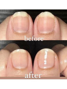 ネイルケアで整った自爪に