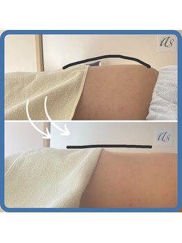 アエラ(AERA)/【半身コース７０分】施術後