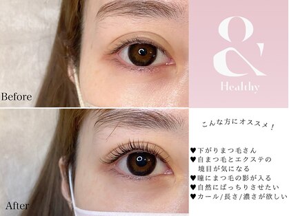 イムア(imua)の写真