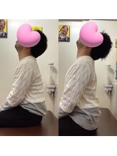 ヒデ整体院(Hide整体院)/猫背矯正骨盤矯正B/A肩こり腰痛