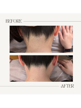 スプランドゥール(Splendeur)/うなじ ワックス脱毛&光脱毛