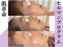 ラヴィニティ 池袋(Lavinity)/セルマン