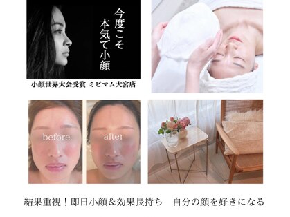 ミピマムソウォン(Mipimam Sowon)の写真