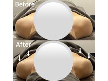 ベール(BEHL)/コルギのBefore After