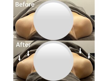 ベール(BEHL)/コルギのBefore After