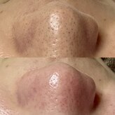 シューティングハーツ(SHOOTING HEARTS)