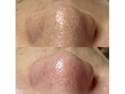 シューティングハーツ(SHOOTING HEARTS)の写真