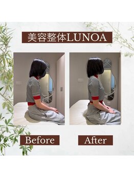 美容整体LUNOA　神戸三宮院/姿勢・巻き肩・肩こりも徹底ケア