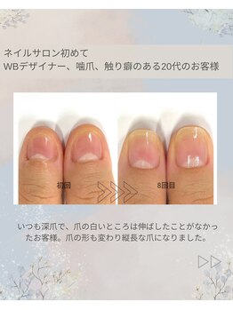 最強ネイルケア