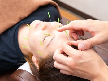 もみの木鍼灸接骨院/【美容鍼】お肌もスッキリ
