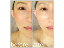 アン グレーヌ 自由が丘(unegraine)/まぶたもスッキリ美しく♪