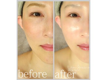 アン グレーヌ 自由が丘(unegraine)/まぶたもスッキリ美しく♪