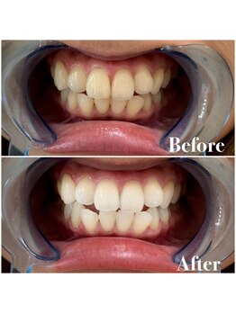 ライトビューティー 池袋店(LightBeauty)/症例写真